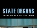 State Organs: Transplant Abuse in China (Organes de l’Etat) publié par David Matas et Dr Torsten Trey