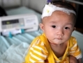 Le 22 septembre 2008, un bébé qui souffre de calculs rénaux après avoir bu du lait en poudre contaminé, reçoit un traitement à l’hôpital pour enfants de Chengdu dans la province du Sichuan en Chine. (China Photos/Getty Images)  