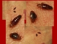 Un gros plan sur des punaises de lit sur la peau de différents individus (Louento.pix)