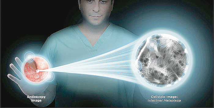 Biopsie optique en temps réel: un grand pas en avant dans le dépistage des cancers