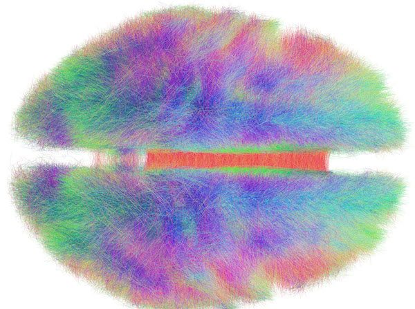 Le connectome est un plan complet des connexions neuronales dans un cerveau. 