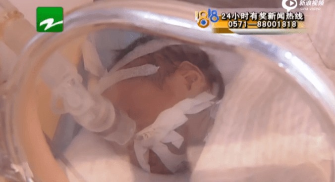 Le bébé sous étroit contrôle médical à l'hôpital. (Weibo.com)