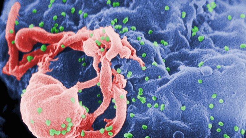 Micrographie électronique à balayage du VIH-1 (en vert) à partir de lymphocytes cultivés. Cette image a été colorée pour mettre en évidence des caractéristiques importantes. Plusieurs bosses rondes sur la surface des cellules représentent des sites d’assemblage et le bourgeonnement des virions. (wikimedia)