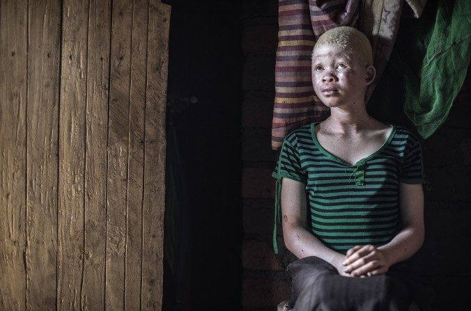 Catherine Amidu, une jeune malawite de 12 ans, assise dans sa maison, dans la région d'autorité traditionnelle Nkole, dans le district de Machinga au Malawi, le 17 avril 2015. (Gianluigi Guercia/AFP/Getty Images) 