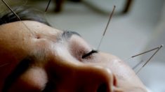 Acupuncture et médecine chinoise pour la santé mentale (I)