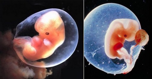 Embryon humain de 6 semaines. (Capture d'écran)