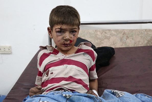 Un enfant syrien blessé reçoit un traitement dans un hôpital de fortune suite à un bombardement du gouvernement dans la ville assiégée par les rebelles.
(ABDULMONAM EASSA/AFP/Getty Images)
