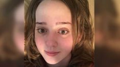 Une sœur attentionnée se tourne vers Internet pour obtenir de l’aide alors que l’acné de son frère autiste ne disparait pas