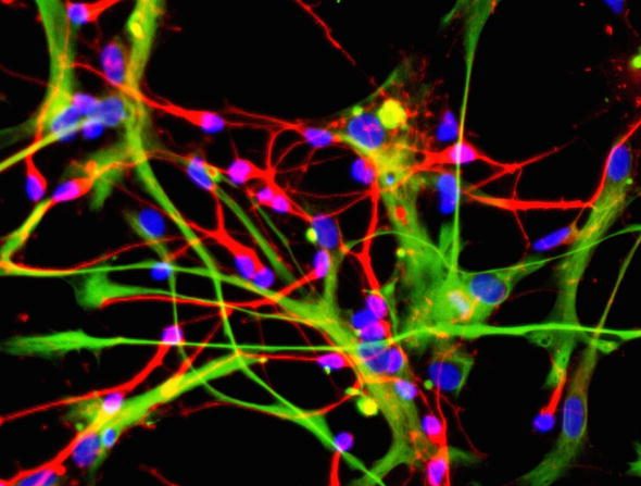 Les cellules souches ouvrent des portes vers une meilleure compréhension des maladies neurologiques, dans le traitement de troubles neurodégénératifs tels que la maladie de Huntingdon et la maladie de Parkinson. Photo par l'Institut de recherche sur les cellules souches via Getty Images.