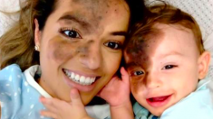 Une mère ‘très émue’ après avoir peint une grosse tache de naissance sur son visage – un acte d’amour inconditionnel pour son fils