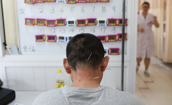 -Une patiente en traitement d'acupuncture dans un hôpital de Shenyang, dans la province du Liaoning (nord-est de la Chine). L'acupuncture est un élément crucial de la médecine traditionnelle chinoise, utilisée pour traiter un large éventail de maladies. Photo STR / AFP / Getty Images.