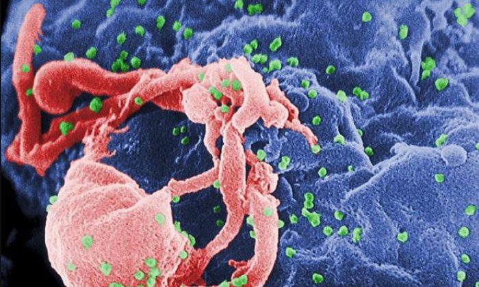 Photo de dossier non datée montrant une micrographie électronique du VIH-1 (en vert) bourgeonnant à partir d'un lymphocyte cultivé. (Domaine public)