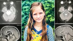 La tumeur au cerveau incurable d’une fillette disparaît comme par miracle – ses parents disent que «Dieu a guéri Roxli»