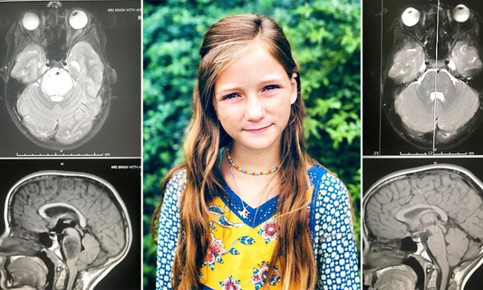 Roxli Doss, 11 ans, et ses scintigraphies du cerveau qui ont fasciné tous ses médecins.  (G : Facebook | Scott Doss, C : Facebook | Gena Layne Doss, D : Facebook | Scott Doss)

