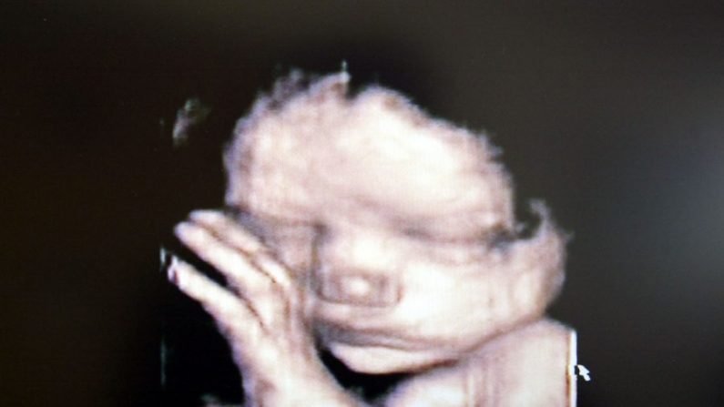 Une échographie 3D montrant un bébé dans l'utérus. (Fotopress/Getty Images)