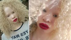 Une fillette albinos était intimidée pour son apparence, elle reçoit maintenant des appels d’agences de mannequins