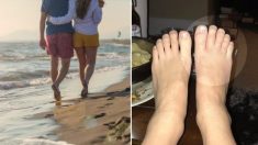 Des dizaines de vers s’introduisent par les pieds nus d’un couple pendant leurs vacances sur une plage des Caraïbes