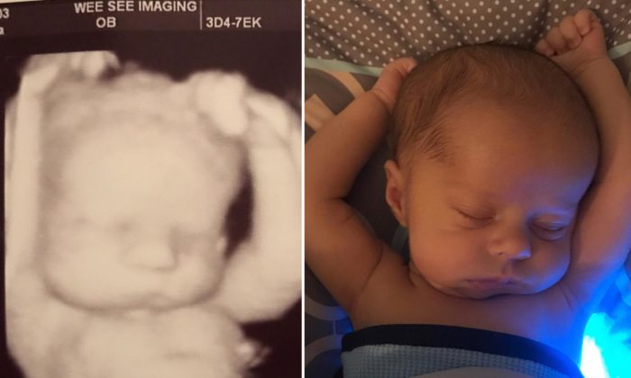 Une échographie montre un «petit gars» dans une position très décontractée dans le ventre de sa mère