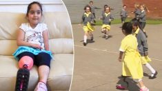 Une petite fille montre sa nouvelle prothèse de jambe rose à ses amis, leur réaction n’a pas de prix
