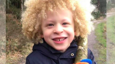 Un enfant de 5 ans qui avait honte de son albinisme est maintenant un modèle pour une marque de mode