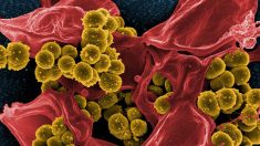 Résistance microbienne : à l’hôpital, les désinfectants devraient être aussi contrôlés que les antibiotiques