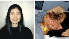 Un visage détruit : l’histoire derrière cette photo qui montre au monde entier la brutalité du régime chinois