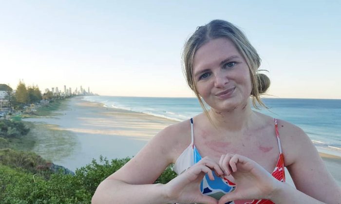 Caitlin Alsop, survivante de l'angine de Ludwig, sur la Gold Coast, Australie, le 19 août 2018. (Caitlin Alsop/Facebook)
