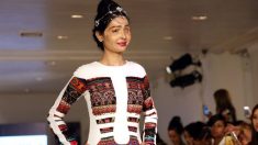 Une jeune fille défigurée par une attaque à l’acide inspire les autres avec son courage lors de la Fashion Week de New York