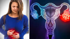 5 signes qui pourraient signaler un cancer de l’ovaire – les stades précoces sont difficiles à détecter, voici comment