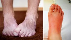 10 choses que vos pieds révèlent sur votre santé – vos pieds sont-ils toujours froids ?