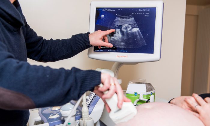 Une femme enceinte qui passe une échographie. (Jasper Jacobs/AFP/Getty Images)