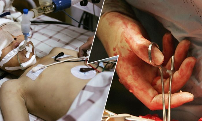 (À gauche : Un garçon chinois hospitalisé. (Photos de Chine / Images de Petty)  À droite : Opération de transplantation rénale. (Christopher Furlong/Getty Images))
