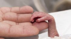 Un bébé avec une rare maladie de peau rejeté par ses parents reçoit une deuxième chance de la part de son grand-père