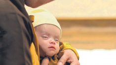 Un bébé prématuré avec une blessure à la tête infestée d’asticots, trouvé dans un sac plastique, se bat pour sa vie