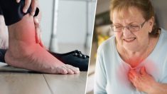 5 affections alarmantes liées aux pieds enflés. Le no 5 est l’insuffisance cardiaque