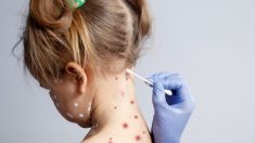 Une fillette de 6 ans avait l’intention de ne pas aller à l’école mais ensuite sa «varicelle» ne disparaît pas