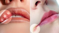 Dix choses que vos lèvres disent au sujet de votre santé – Les picotements des lèvres peuvent indiquer qu’un accident vasculaire cérébral est imminent