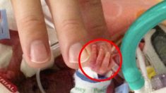 Un minuscule bébé prématuré de 340g n’avait aucune chance de survie, regardez maman le tenir pour la première fois