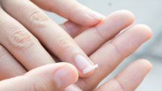 Une mise en garde d’une femme devient virale après avoir découvert que des ongles courbés sont un signe de cancer du poumon