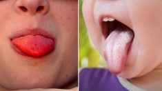 13 choses que votre langue indique sur votre santé – une langue rouge vif indique qu’il faut consulter un médecin