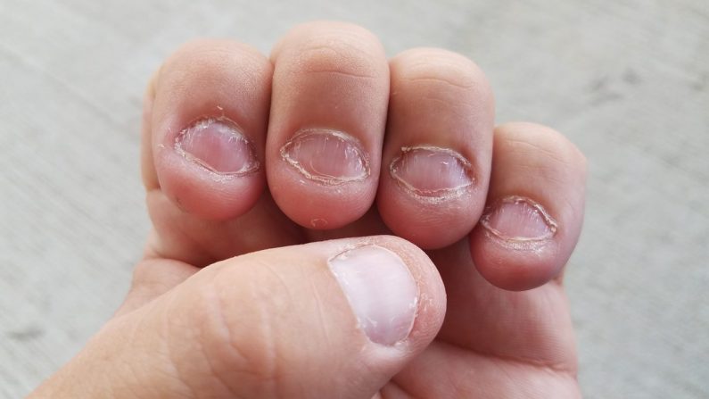 La cause fondamentale de ce comportement ne releverait pas simplement de la nervosité mais plutôt d'une sorte de perfectionnisme.(Illustration - Shutterstock)