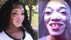 Une femme atteinte d’un vitiligo en forme de cœur sur le visage enlève définitivement son «masque» pour aider une petite fille anxieuse