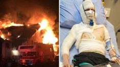 Pour secourir sa nièce de 8 ans, un jeune homme se précipite dans une maison en feu et se brûle au 3e degré