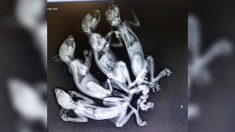 4 bébés écureuils sont trouvés avec des queues tressées ensemble, les vétérinaires suspectent une maltraitance
