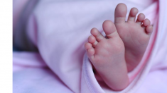 Inde: un bébé naît avec quatre jambes et trois mains après s’être uni à son jumeau in utero