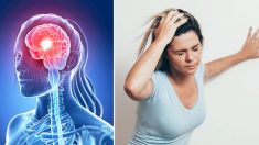 7 signes avant-coureurs d’une « attaque cérébrale » qui apparaît près d’un mois avant l’AVC