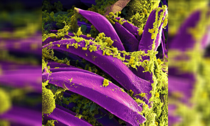 Image de la bactérie Yersinia pestis, identifiée chez deux patients chinois. (Photo: Institut américain des maladies infectieuses allergiques)