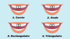 La forme de vos deux dents de devant pourrait être en lien avec votre personnalité