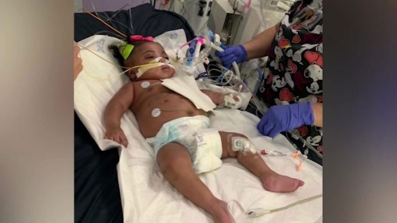 Tinslee Lewis, 9 mois, est gardé en vie sous respirateur artificiel. (Trinity Lewis/Handout)
