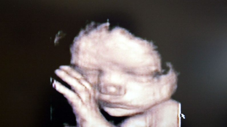 Photo d'illustration. Une échographie 3D qui montre un bébé dans l'utérus. (Fotopress/Getty Images)